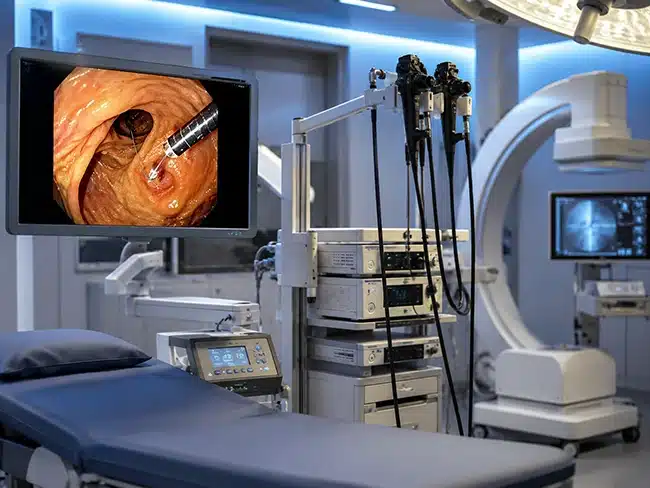 Equipo médico utilizado en un procedimiento CPRE