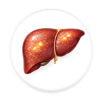 Ilustración médica de enfermedad hepática